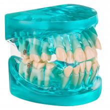 Демонстрационная модель Revyline "Зубы" с ортодонтическими имплантами в Краснодаре